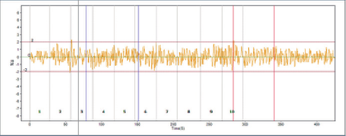 CBP2000De vibration and deformation curve